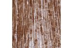 Immunohistochemical staining of human heart muscle shows strong cytoplasmic positivity in myocytes.