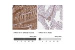 Immunohistochemical staining of human heart muscle shows strong cytoplasmic positivity in myocytes.