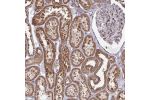 Immunohistochemical staining of human kidney shows strong cytoplasmic positivity in renal tubules.