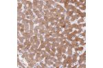 Immunohistochemical staining of human liver shows moderate cytoplasmic positivity in hepatocytes.