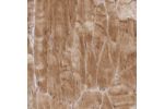 Immunohistochemical staining of human skeletal muscle shows strong cytoplasmic positivity in myocytes.