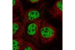 Immunofluorescent staining of human cell line A-431 shows localization to nucleoplasm.