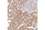Immunohistochemical staining of human kidney shows moderate cytoplasmic positivity in cells in tubules.