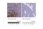 Immunohistochemistry analysis in human lymph node and endometrium tissues using HPA060715 antibody. Corresponding CR2 RNA-seq data are presented for the same tissues.