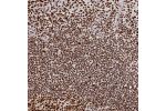 Immunohistochemical staining of human tonsil shows strong nuclear positivity.