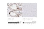 Immunohistochemistry analysis in human testis and skeletal muscle tissues using HPA060744 antibody. Corresponding CHD2 RNA-seq data are presented for the same tissues.
