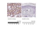 Immunohistochemistry analysis in human kidney and skin tissues using HPA060904 antibody. Corresponding SLC5A12 RNA-seq data are presented for the same tissues.