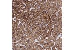 Immunohistochemical staining of human liver shows strong cytoplasmic positivity in hepatocytes.
