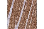 Immunohistochemical staining of human smooth muscle shows strong cytoplasmic positivity in smooth muscle cells.
