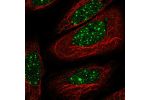 Immunofluorescent staining of human cell line SiHa shows localization to nuclear bodies.
