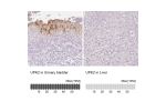 Immunohistochemistry analysis in human urinary bladder and liver tissues using HPA061106 antibody. Corresponding UPK2 RNA-seq data are presented for the same tissues.