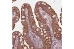 Immunohistochemical staining of human small intestine shows strong cytoplasmic and membranous positivity in glandular cells.