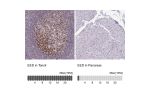 Immunohistochemistry analysis in human tonsil and pancreas tissues using HPA061140 antibody. Corresponding EED RNA-seq data are presented for the same tissues.