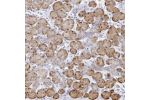 Immunohistochemical staining of human salivary gland shows moderate cytoplasmic and nuclear positivity in glandular cells.