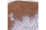 Immunohistochemical staining of human esophagus shows strong cytoplasmic positivity in squamous epithelial cells.