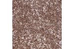 Immunohistochemical staining of human lymph node shows strong nuclear positivity in germinal and non-germinal center cells.
