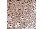 Immunohistochemical staining of human placenta shows strong cytoplasmic positivity in decidual cells.
