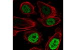 Immunofluorescent staining of human cell line PC-3 shows localization to nucleoplasm.