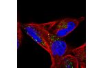 Immunofluorescent staining of human cell line RH-30 shows localization to vesicles.
