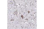 Immunohistochemical staining of human cerebral cortex, colon, hypothalamus and testis using Anti-CALCR antibody HPA061428 (A) shows similar protein distribution across tissues to independent antibody HPA028962 (B).