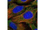 Immunofluorescent staining of human cell line U-2 OS shows localization to cytosol & vesicles.