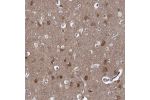 Immunohistochemical staining of human cerebral cortex shows moderate cytoplasmic positivity in neuronal cells.