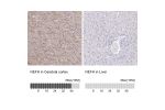 Immunohistochemistry analysis in human cerebral cortex and liver tissues using HPA061615 antibody. Corresponding NEFH RNA-seq data are presented for the same tissues.
