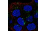 Immunofluorescent staining of human cell line RT4 shows localization to the Golgi apparatus.