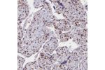 Immunohistochemistry analysis in human gallbladder and pancreas tissues using Anti-GTF2B antibody. Corresponding GTF2B RNA-seq data are presented for the same tissues.