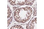 Immunohistochemical staining of human testis shows strong nuclear positivity in cells in seminiferous ducts.