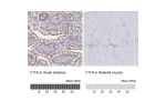 Immunohistochemistry analysis in human placenta and pancreas tissues using Anti-F11R antibody. Corresponding F11R RNA-seq data are presented for the same tissues.