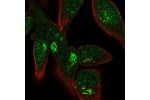 Immunofluorescent staining of human cell line RH-30 shows localization to nucleus & the Golgi apparatus.