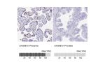 Immunohistochemistry analysis in human placenta and prostate tissues using HPA061745 antibody. Corresponding LIN28B RNA-seq data are presented for the same tissues.