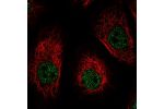 Immunofluorescent staining of human cell line A549 shows localization to nucleoplasm.