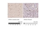 Immunohistochemistry analysis in human cerebral cortex and placenta tissues using Anti-STK39 antibody. Corresponding STK39 RNA-seq data are presented for the same tissues.