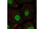 Immunofluorescent staining of human cell line A549 shows localization to nucleus.