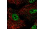 Immunofluorescent staining of human cell line A549 shows localization to nuclear speckles & vesicles.