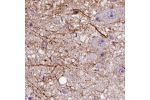 Immunohistochemical staining of human caudate shows strong positivity in neuronal projections.