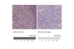 Immunohistochemistry analysis in human tonsil and pancreas tissues using HPA062029 antibody. Corresponding BTLA RNA-seq data are presented for the same tissues.