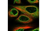 Immunofluorescent staining of human cell line U-2 OS shows localization to nuclear membrane, cytosol & vesicles.