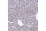 Immunohistochemical staining of human pancreas shows moderate membranous positivity in exocrine glandular cells.