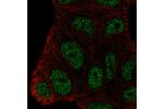 Immunofluorescent staining of human cell line RT4 shows localization to nucleoplasm.