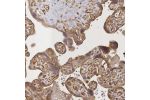Immunohistochemical staining of human placenta shows cytoplasmic positivity in trophoblasts.