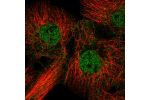 Immunofluorescent staining of human cell line A-431 shows localization to nucleoplasm.
