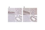 Immunohistochemical staining of human cerebellum, kidney, liver and testis using Anti-SIN3A antibody HPA062123 (A) shows similar protein distribution across tissues to independent antibody HPA047213 (B).