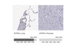 Immunohistochemistry analysis in human lung and pancreas tissues using HPA062148 antibody. Corresponding SFTPB RNA-seq data are presented for the same tissues.