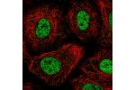 Immunofluorescent staining of human cell line A549 shows localization to nucleoplasm.