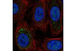 Immunofluorescent staining of human cell line A549 shows localization to nucleoplasm & cytosol.