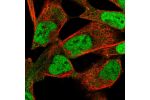 Immunofluorescent staining of human cell line RH-30 shows localization to nucleoplasm.