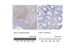 Immunohistochemistry analysis in human adrenal gland and rectum tissues using HPA062262 antibody. Corresponding DLK1 RNA-seq data are presented for the same tissues.